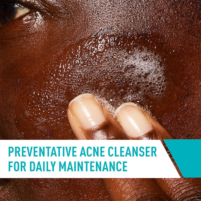 Acne Cleanser Texture