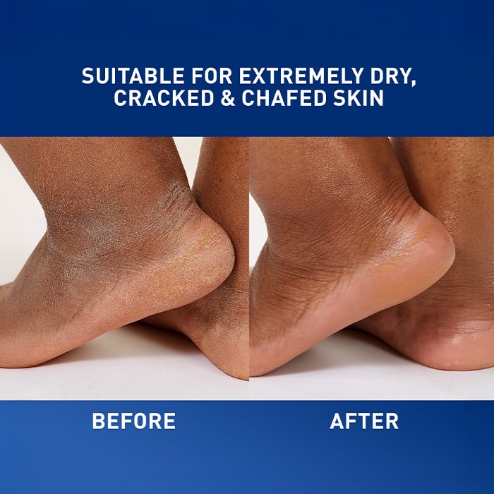 CeraVe Skincare Moisturizers Healing Ointment