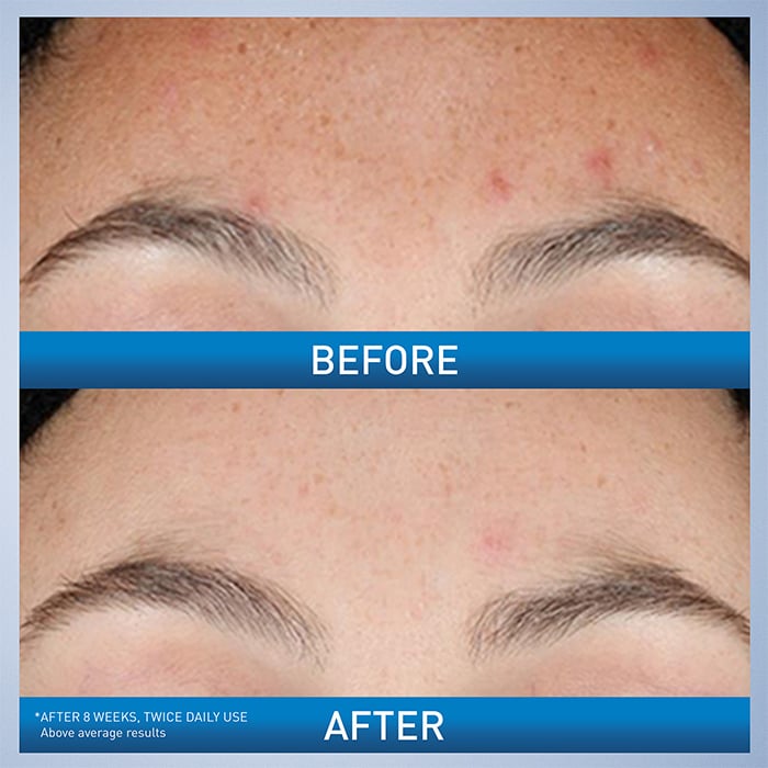 CeraVe Skincare Serums Resurfacing Retinol Serum